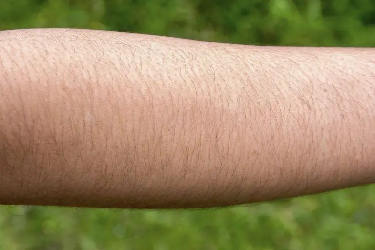 How to Get Rid of Arm Hair | GetRidofThings.com