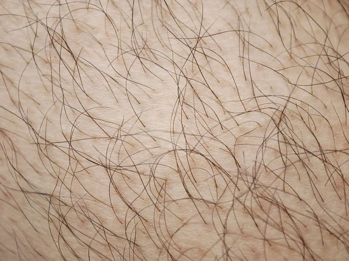 Как растут волосы у девушек в паховой области
