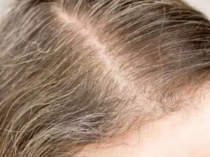 A woman's hair beginning to gray.