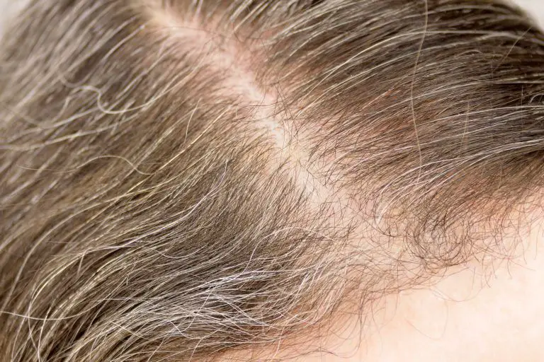 How to Get Rid of Gray Hair