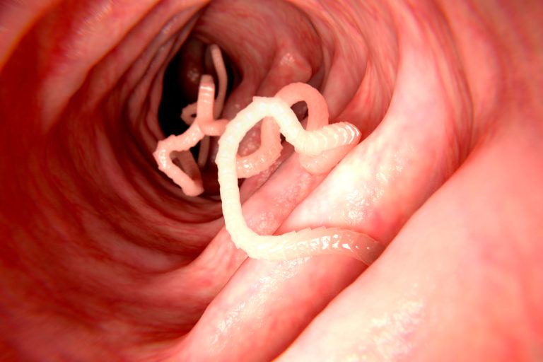 Tapeworms